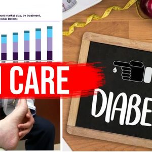 Skin Care In Diabetic Patients | Skin and Diabetes | Dr. Kalyan