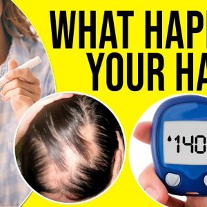 What Happens Your Hair While You Have Diabetes - Diabetes and Hair | Dr. G Kalyan Chakravarthy
