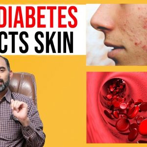 How Diabetes Affects Skin - What Skin Problems Does Diabetes Cause? | Dr. Kalyan Chakravarthy