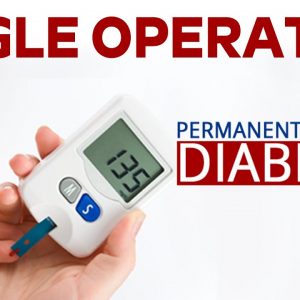 Only One Single Operation To Cure Diabetes Permanently | Can Diabetes Be Surgically Cured