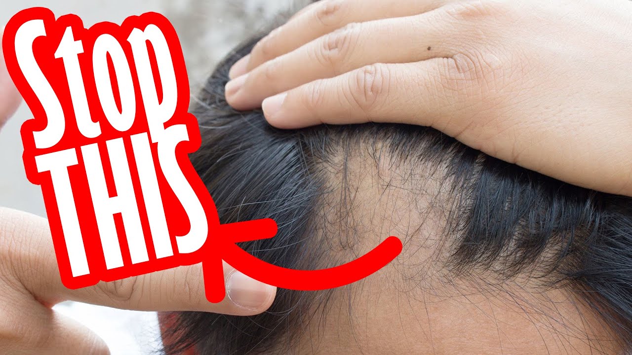Why Is My Hair Falling Out? - How To STOP HAIR LOSS - Dr. Goutham Kumar