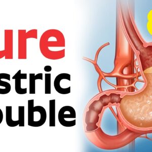 Top 10 Foods To Prevent Gastritis Problem | Food For Acidity - Dr. CL Venkata Rao