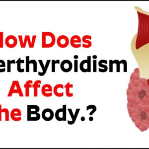 How Does Hyperthyroidism Affect The Body.? - Dr Kalyan Chakravarthy