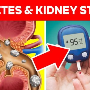 Kidney Stones and Diabetes - Can Kidney Stones Increase Blood Sugar | Free Diabetes