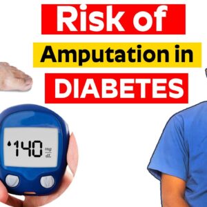 Risk of Amputation in Diabetic Patients | How to avoid Amputation || Dr. Gnaneswar Atturu