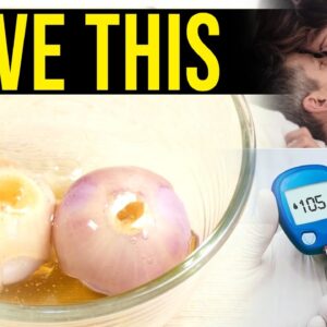 Solve This Problems - Onion Will Improve This | Diabetes Health Complications