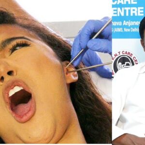How to Clean Your Ears - Dr. Chava Anjaneyulu | Free Diabetes