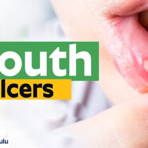 What Happens If I Have Mouth Ulcers  | Dr. Chava Anjaneyulu
