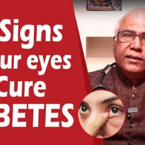 These Signs In Your Eyes Can Control Diabetes | DR C L Venkat Rao| FREE DIABETES