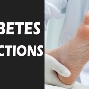 Why patients Get Diabetes Infections | DR Dilip Gude | Free Diabetes