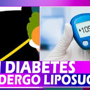 Can Diabetes Undergo  Liposuction | Best Health Tips | DR C L Venkat Rao | Free Diabetes