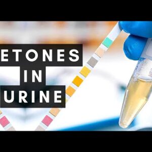 You SHOULD Know This About Ketones in Urine