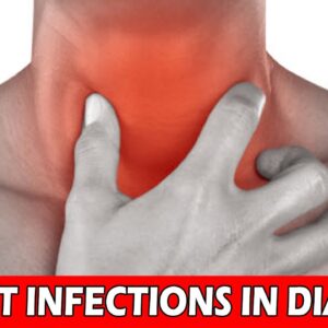 Throat Infection In Diabetes | DR Hemanth kumar | Free Diabetes