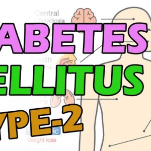 What Is Diabetes Mellitus Type -2 | DR Athaullah | Free Diabetes