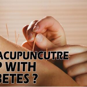 Can Acupuncture Help With Diabetes | DR P.S Sagar | Free Diabetes