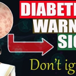 How To Prevent Skin Issues In Diabetes | Tips To Avoid The Common Skin Problems Caused By Diabetes