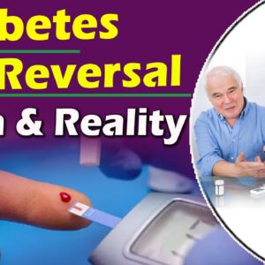 Is diabetes reversible ? or Not | How to prevent diabetes | Diabetes control Tips | #Free Diabetes