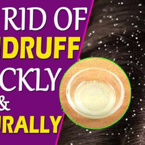 How To Get Rid Of Dandruff Quickly And Easily! | Easy Home Remedies | Healthy Dandruff Care Tips