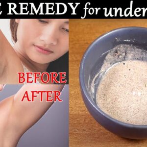 How to Get Rid of Dark Underarms | Remedy to Lighten your Armpits | Free Diabetes