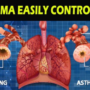 what is Asthma ? Asthma - causes, symptoms, diagnosis, treatment, pathology |  FREE DIABETES