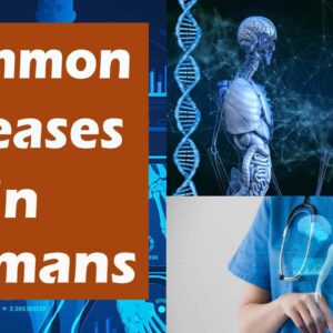 What are Common diseases in human ? |Free Diabetes