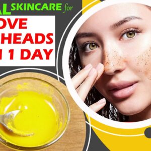 Bye Bye Blackheads with These One Homemade Face Packs | #Nature Cure Fit