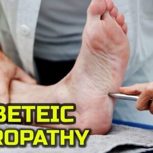Managing Diabetic Neuropathy | Free Diabetes