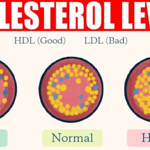 Understanding Cholesterol Levels | LDL (Bad) vs HDL (Good) Cholesterol | Free Diabetes