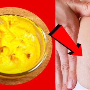 Remove Stretch Marks Completely from all body Parts | Easy Home Remedies