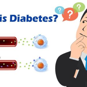 What is diabetes and its types? | Dr. Imran Khan | Free Diabetes