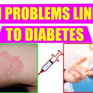 Why Does Diabetes Cause Skin Problems? | Free Diabetes