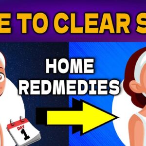 What's inside a pimple? How pimples are formed ? | Home Remedies For Clear Skin | #skincare