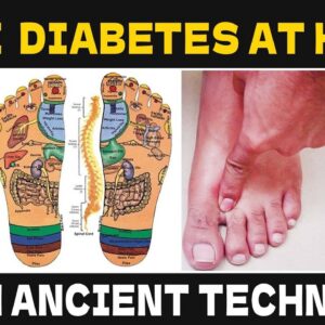 How to Cure Diabetes with Acupressure | Best Acupressure Points for Diabetes Control | Free Diabetes