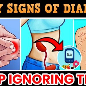 Early Warning Sign Of Diabetes | Diabetes Mellitus | Type 2 Diabetes - Signs & Symptoms |