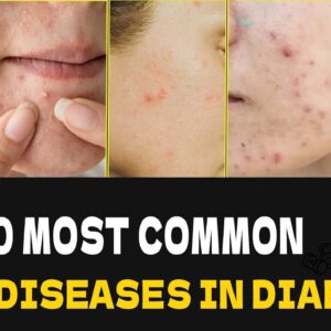 10 Diabetic Skin Problems & Top Signs of Diabetes on The Skin | Diabetics Skin Signs | Free Diabetes