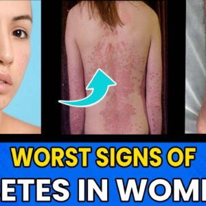 Signs And Symptoms Of Diabetes In Women | #curediabetes | Diabetes In WOMEN | Free Diabetes