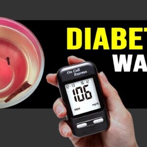 Diabetes Water ( cloves and cinnamon water for diabetes ) | Free Diabetes