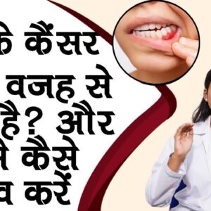Oral Cancer - What Is It? What are the Symptoms and Treatment? Explained By Dr.Anam | #healthtips